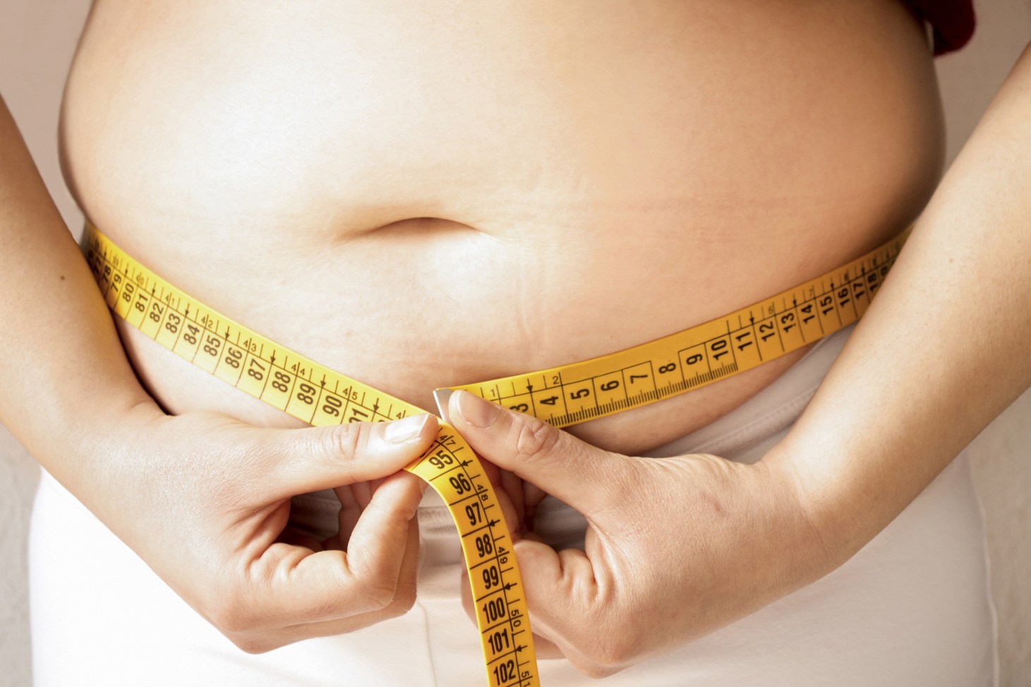 Az elhízás összeurópai problémává nőtte ki magát